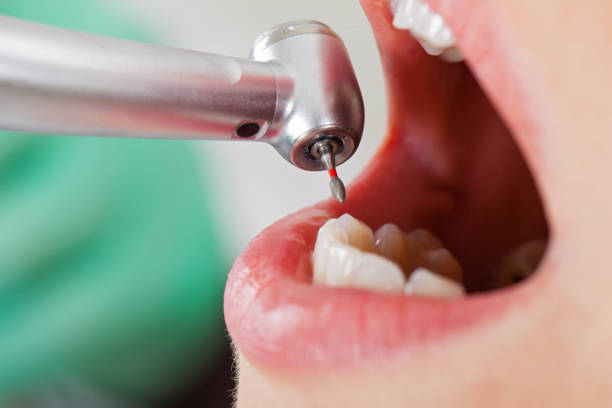 Best Cracked Tooth Emergency Dentist  in Newburyport, MA